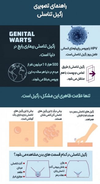  زگیل داخل واژن را چگونه از بین ببریم؟