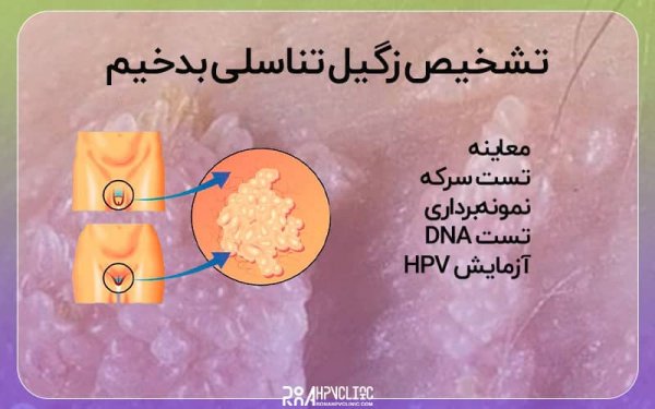  آیا زگیل تناسلی باعث بوی بد واژن می شود؟