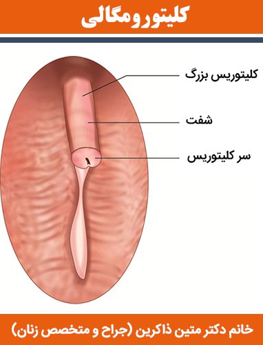 علت بزرگ شدن دستگاه تناسلی زنان