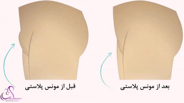  علت بزرگ شدن دستگاه تناسلی زنان
