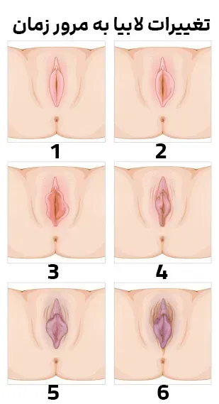  علت بزرگ شدن دستگاه تناسلی زنان