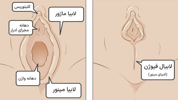  چگونه لابیا را صورتی کنیم؟