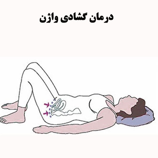  از کجا بفهمم واژنم تنگه یا گشاد؟