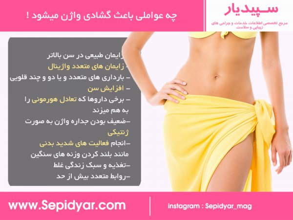  از کجا بفهمم واژنم تنگه یا گشاد؟