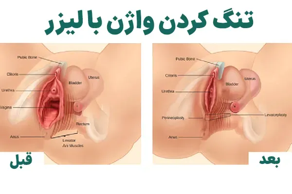  از کجا بفهمم واژنم تنگه یا گشاد؟