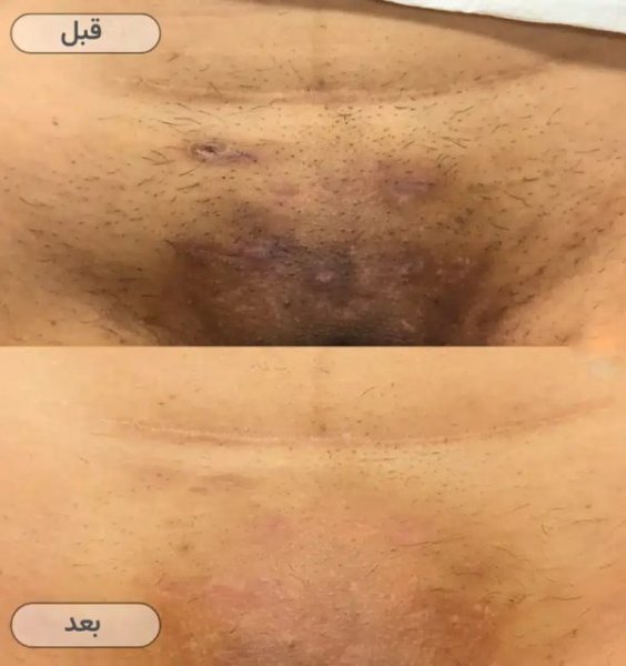  علت سياه شدن كليتوريس