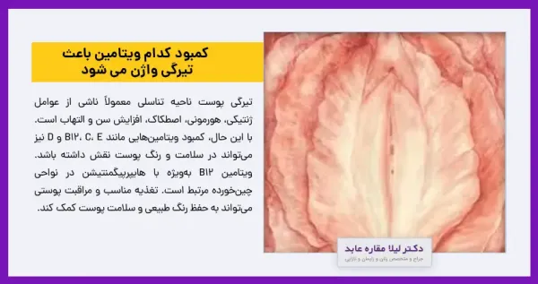  علت سياه شدن كليتوريس