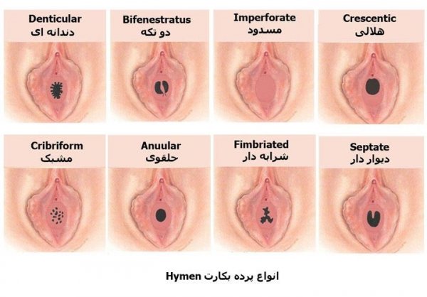  علت سياه شدن كليتوريس