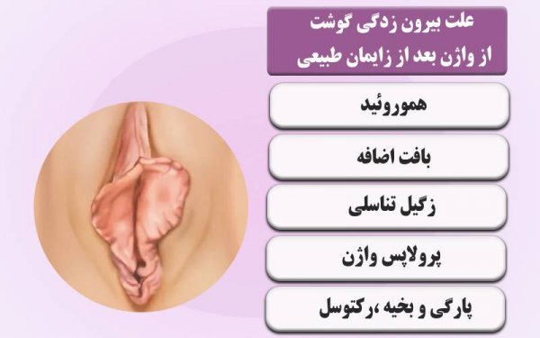  مچ پا چه ربطی به واژن دارد؟