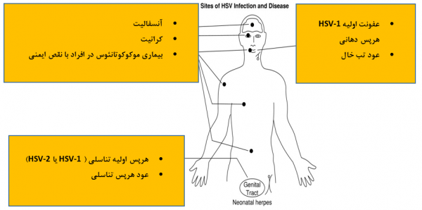  آیا تبخال مقعدی خطرناک است؟