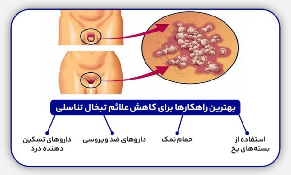  درمان خانگی تبخال مقعدی