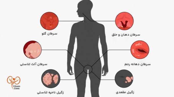 عکس جواب آزمایش hpv مثبت