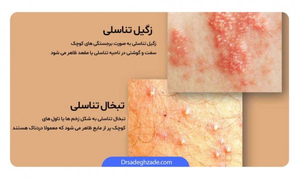  عکس جواب آزمایش hpv مثبت