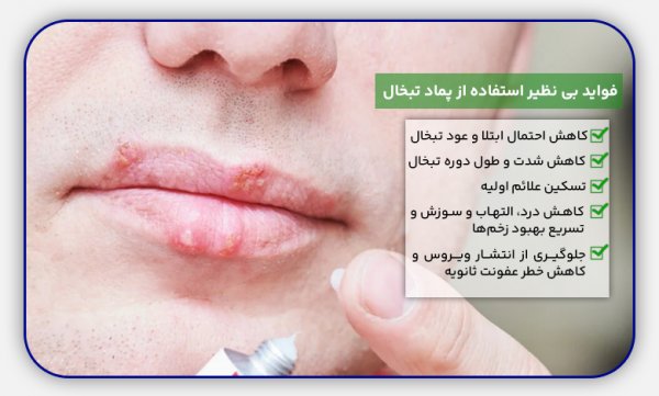  هزینه آزمایش تبخال تناسلی