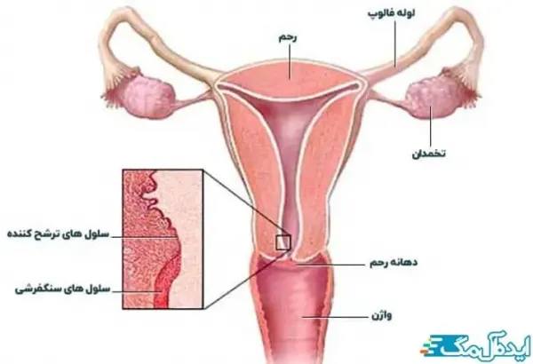  عکس سرطان دهانه رحم
