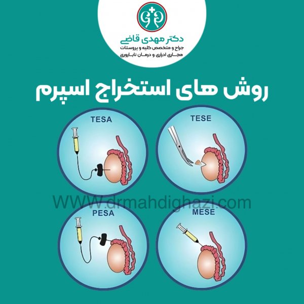  قبل از عقد چه آزمایشی انجام میشود؟