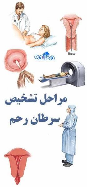  عکس سرطان رحم بدخیم