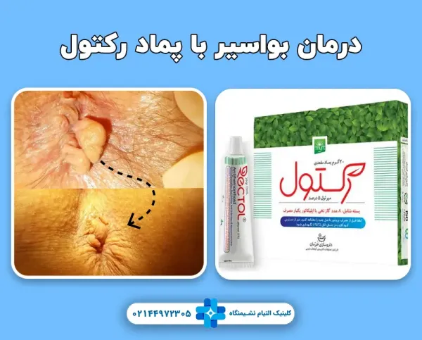  برای عفونت هموروئید چه کنیم + عکس عفونت هموروئید
