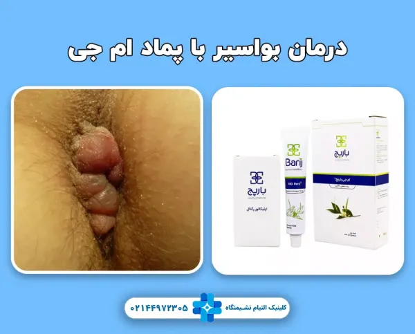 برای عفونت هموروئید چه کنیم + عکس عفونت هموروئید