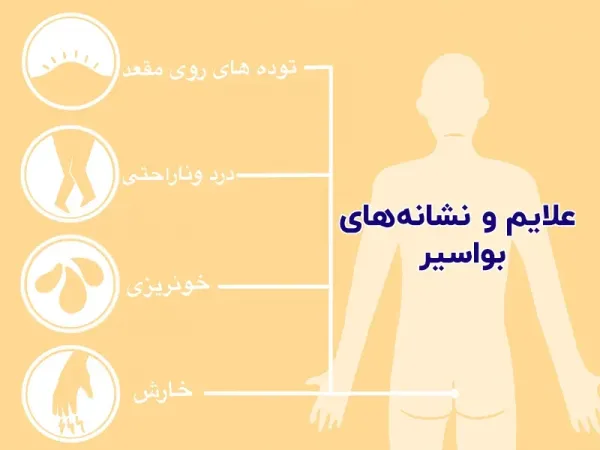 برای درمان زخم هموروئید چه باید کرد؟