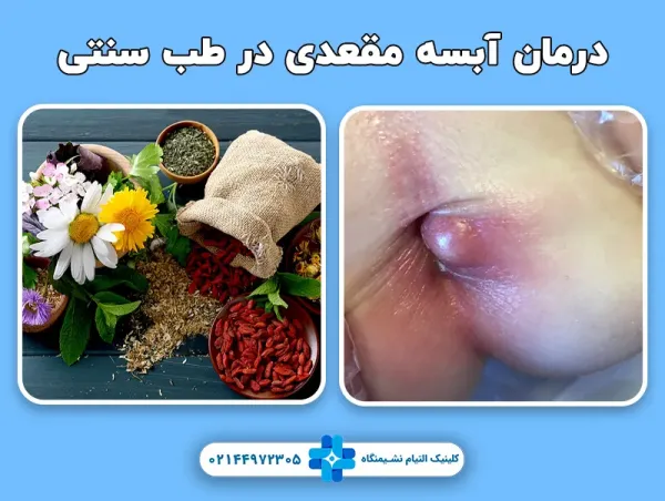 درمان گیاهی عفونت مقعدی زنان