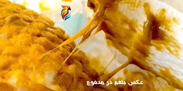 عکس مخاط در مدفوع + دلایل و درمان