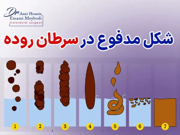  عکس مخاط در مدفوع + دلایل و درمان