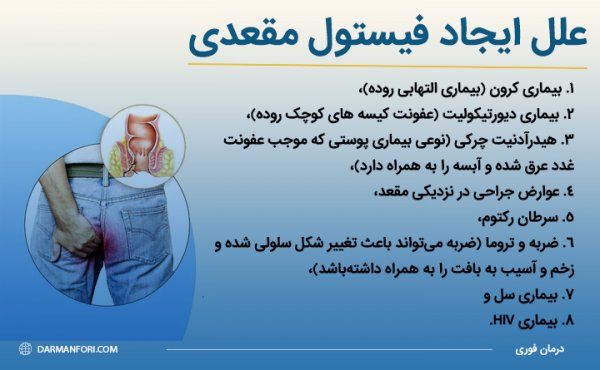  علت فیستول مقعدی در مردان و زنان