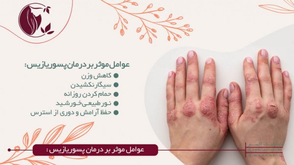  شفا یافتگان پسوریازیس