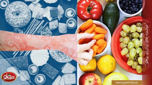  دکتر خوب برای پسوریازیس + رژیم غذایی پسوریازیس + روش های پیشگیری از پسوریازیس