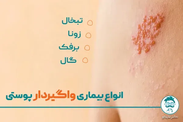  کدام بیماری پوستی خطرناک است؟