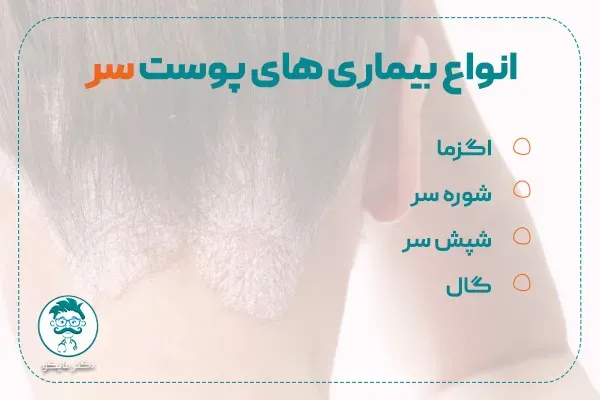  کدام بیماری پوستی خطرناک است؟