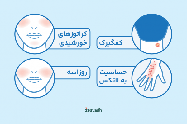  کدام بیماری پوستی خطرناک است؟