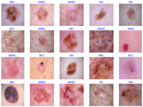  کدام بیماری پوستی خطرناک است؟