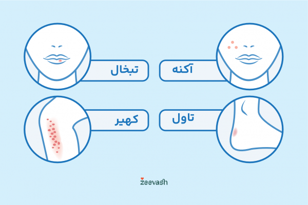  کدام بیماری پوستی خطرناک است؟