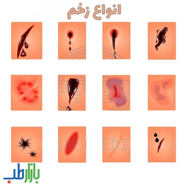  عکس بثورات پوستی + عکس بیماری های پوستی + عکس زخم های پوستی