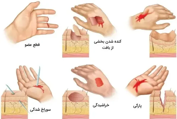  عکس بثورات پوستی + عکس بیماری های پوستی + عکس زخم های پوستی