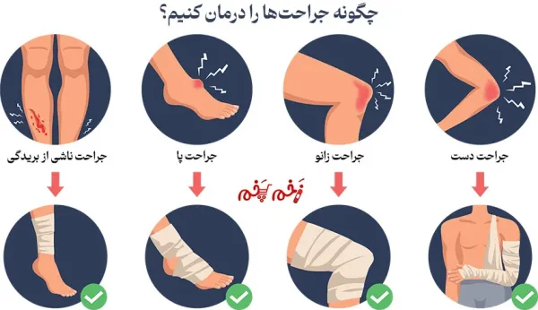  عکس بثورات پوستی + عکس بیماری های پوستی + عکس زخم های پوستی