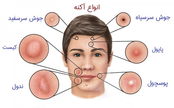  عکس بثورات پوستی + عکس بیماری های پوستی + عکس زخم های پوستی