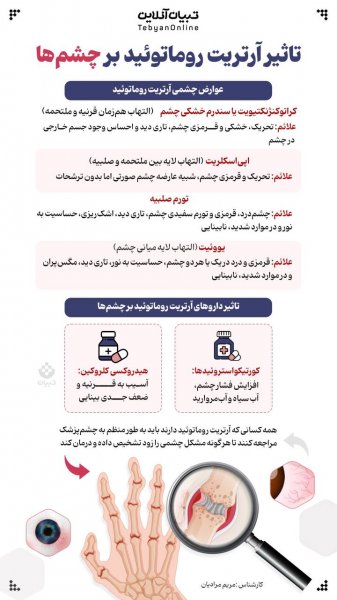  آیا پسوریازیس باعث درد مفاصل می شود + علائم آرتریت پسوریازیس