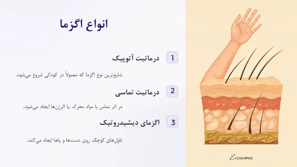  اگر اگزما درمان نشود چه میشود؟