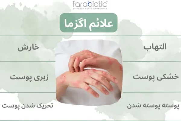  اگر اگزما درمان نشود چه میشود؟