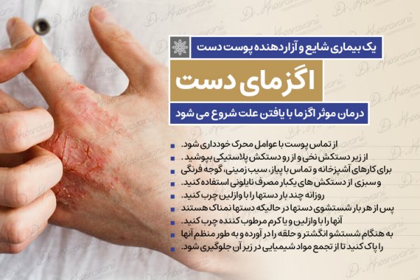  اگر اگزما درمان نشود چه میشود؟