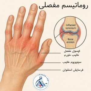  برای التهاب بدن به چه دکتری مراجعه کنیم؟