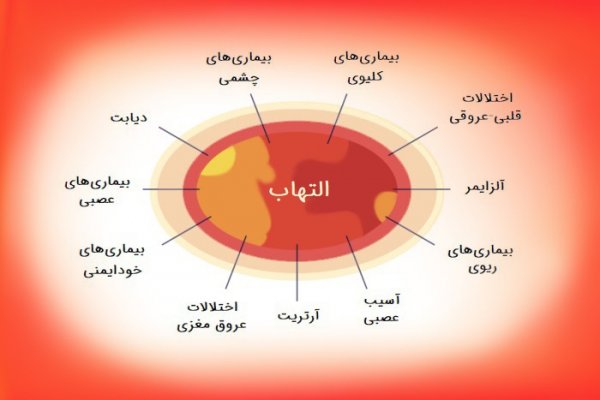  برای التهاب بدن به چه دکتری مراجعه کنیم؟