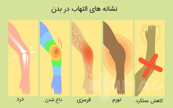  برای التهاب بدن به چه دکتری مراجعه کنیم؟