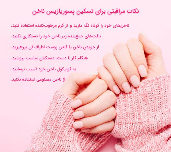  آیا پسوریازیس ناخن درمان قطعی دارد؟