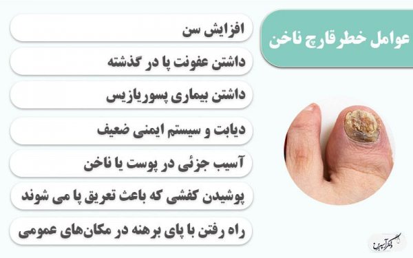  آیا پسوریازیس ناخن درمان قطعی دارد؟