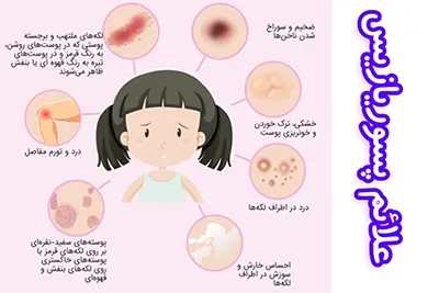  آیا پسوریازیس از پدر به فرزند منتقل میشود + پسوریازیس ارثی است؟