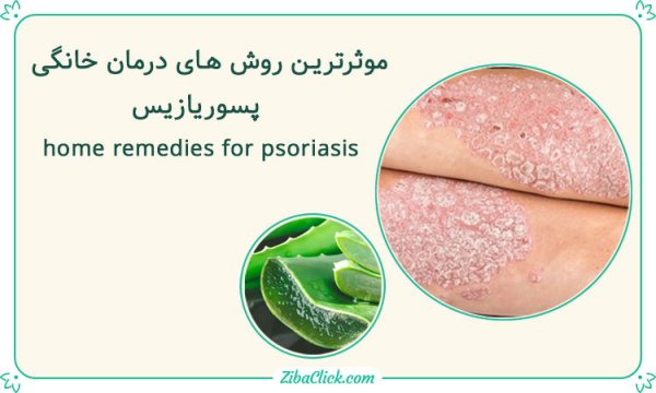  درمان خانگی پسوریازیس تناسلی + علت ، علائم + عوارض